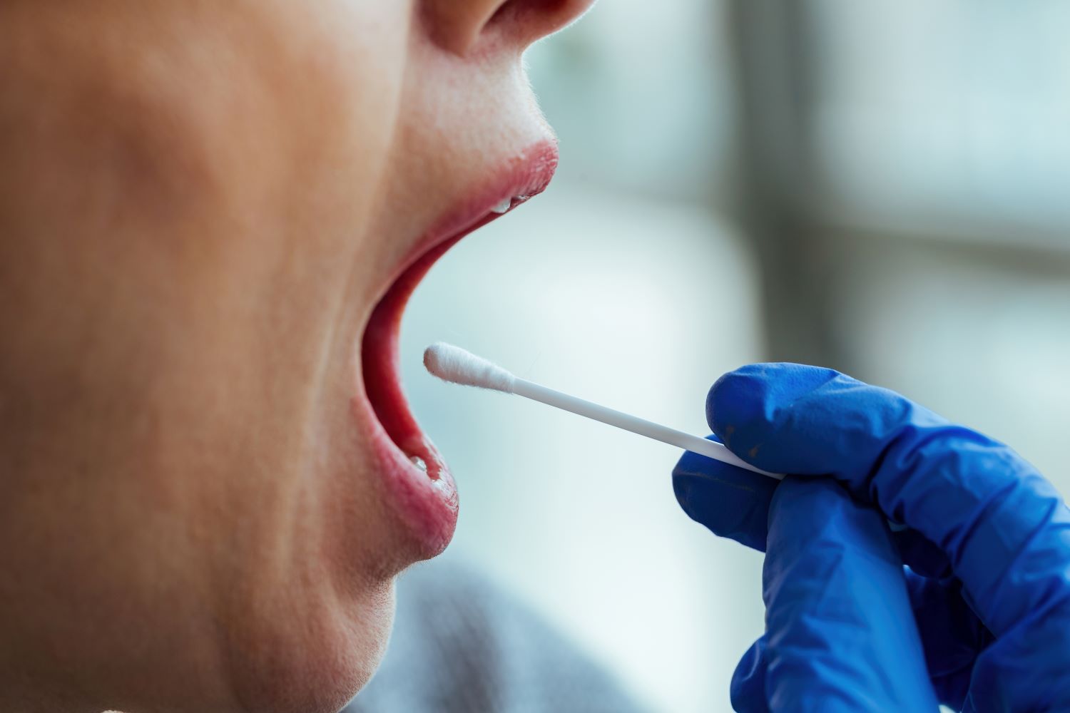 Swabs